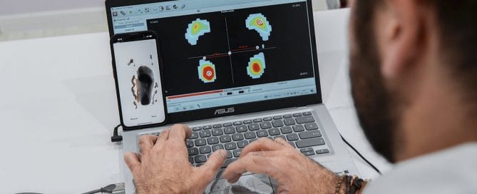 Estudio biomecánico de la pisada en Valladolid